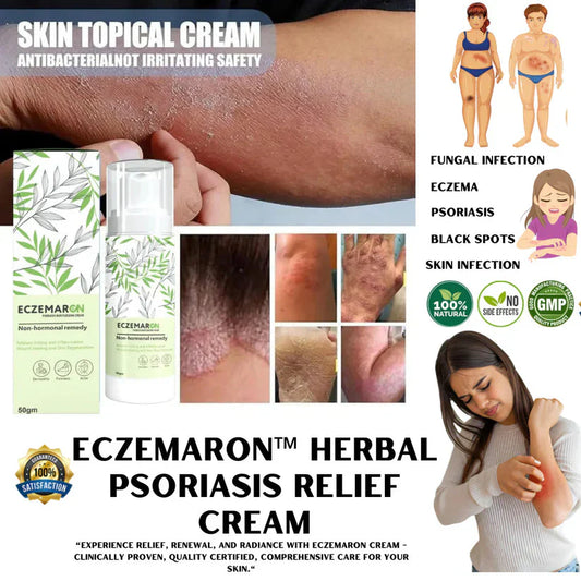 Amigo™️ Eczegone FungalEase Cream with Free Pain Relief Spray | Buy 1 Get 1 Free